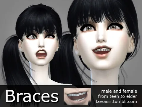 Braces