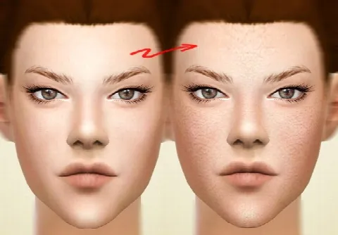 Pores