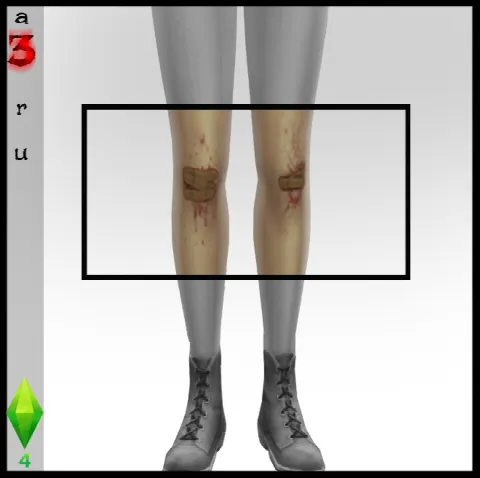 Scraped/Bloody knees with bandaids