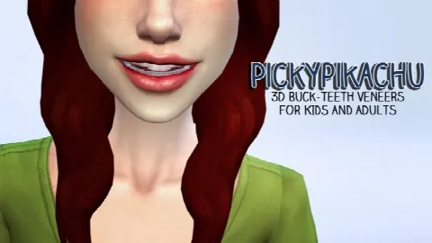 3D Buck-Teeth Veneers for Everyone